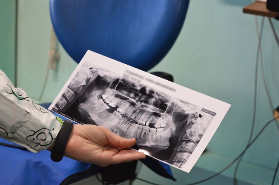    Стоматология. Снимок. Зубы. Источник: Екатерина Жолнерова