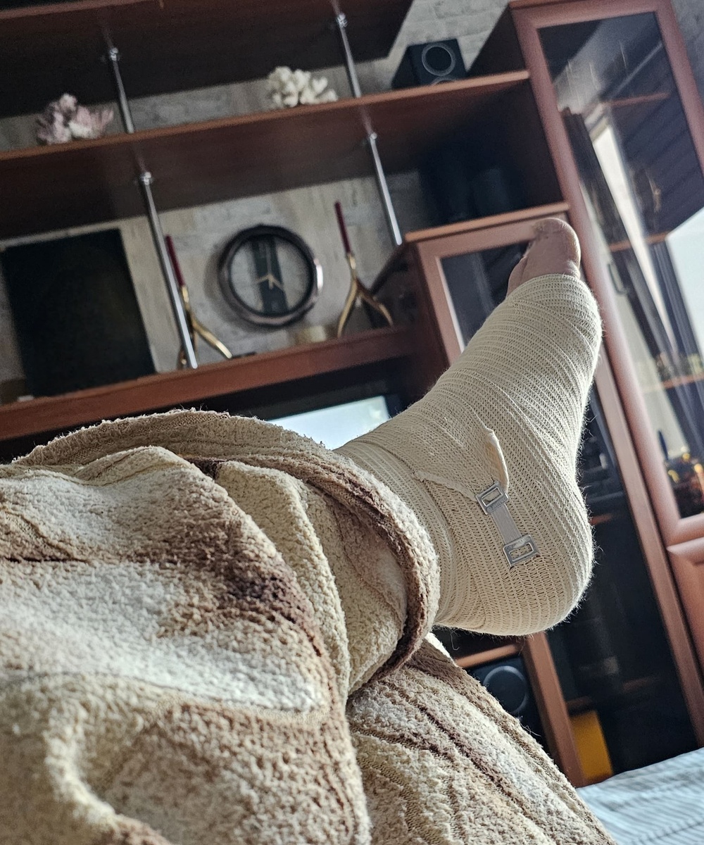 Красота! И такая нога была  уже спустя 5 дней после травмы, как груша.