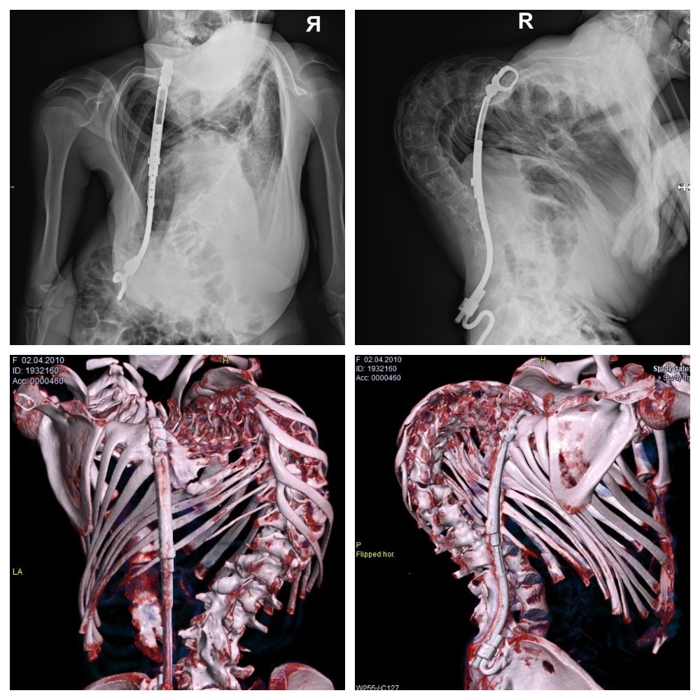 До финальной операции