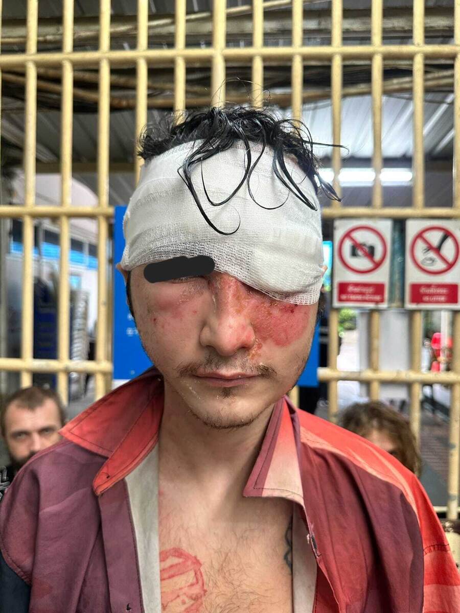 Тюремный фельдшер наложил повязку с лечебной мазью перед отправкой. Имя в тексте изменено. 