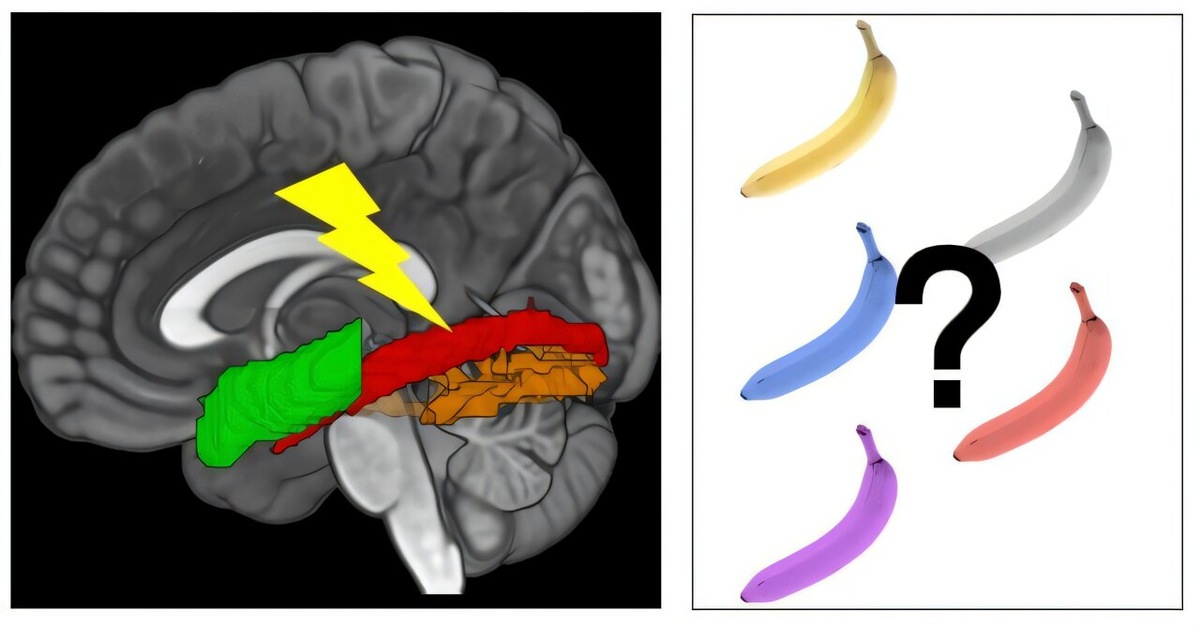    Схематическое изображение основных выводов, адаптированных по фигуре мозга в исследовании.PLOS Biology