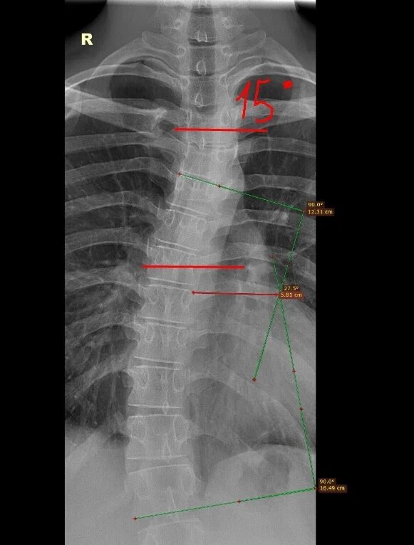 Как были первоначально расчерчены снимки в пол-ке.