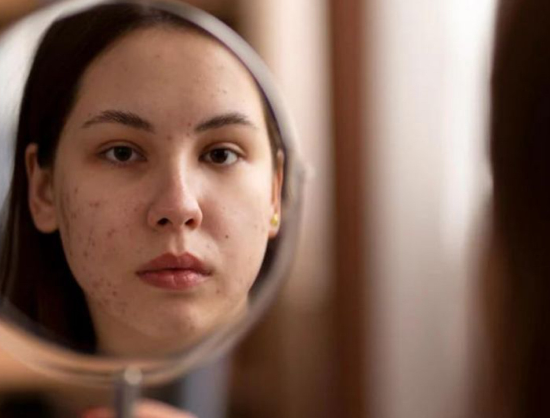 Лактаза - простой способ получить пользу, но без воспалений в жкт и на коже 