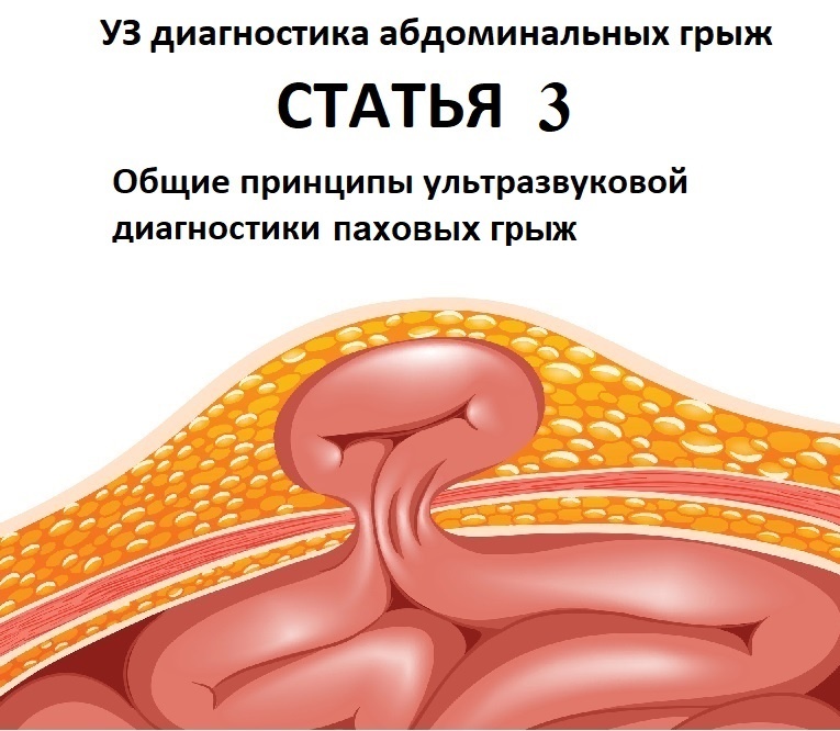 Рис. 00 - заставка. Изображение адаптировано из свободного доступа