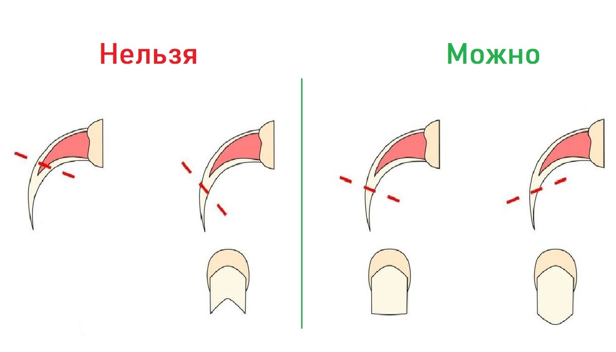 Как правильно подрезать когти