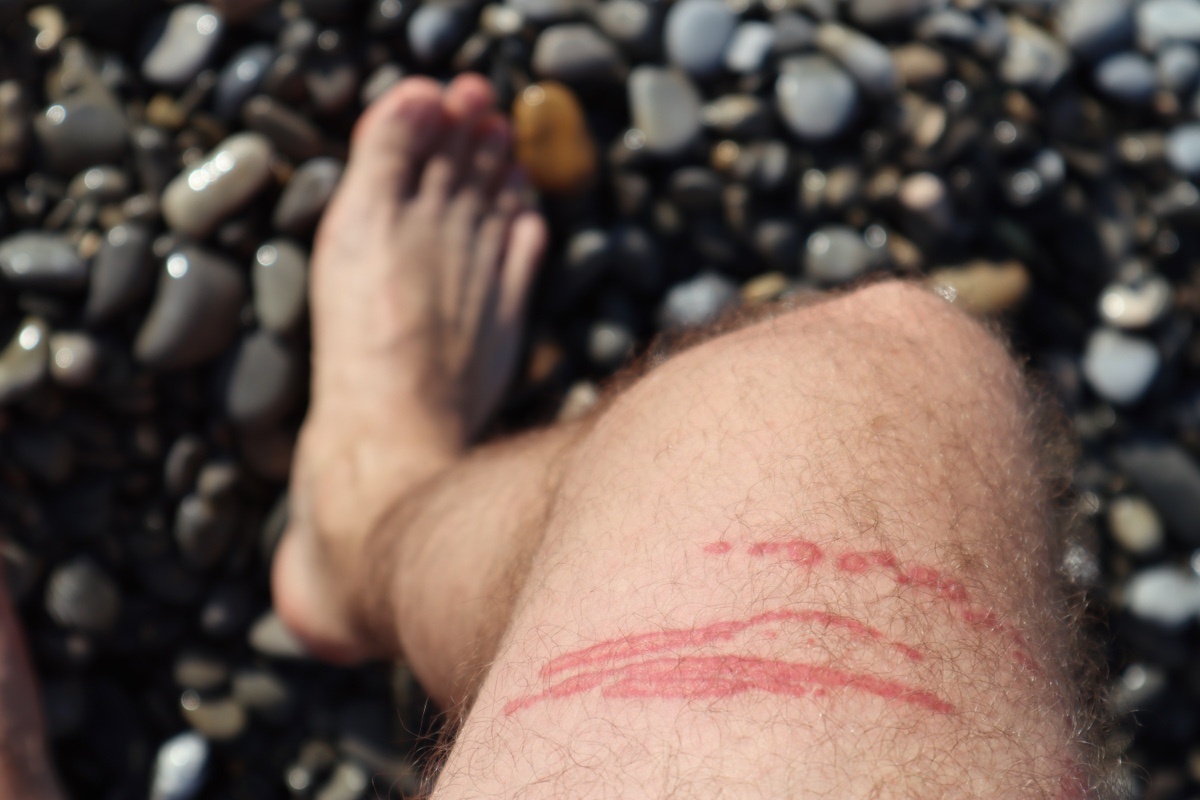    Andrei Antipov / Shuttersock / FOTODOM