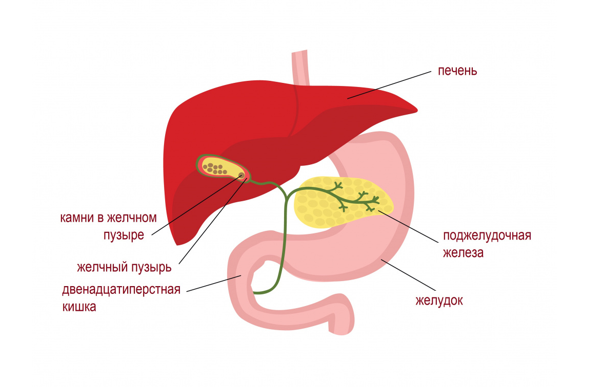 Основная причина образования камней — нарушение работы самого желчного пузыря.