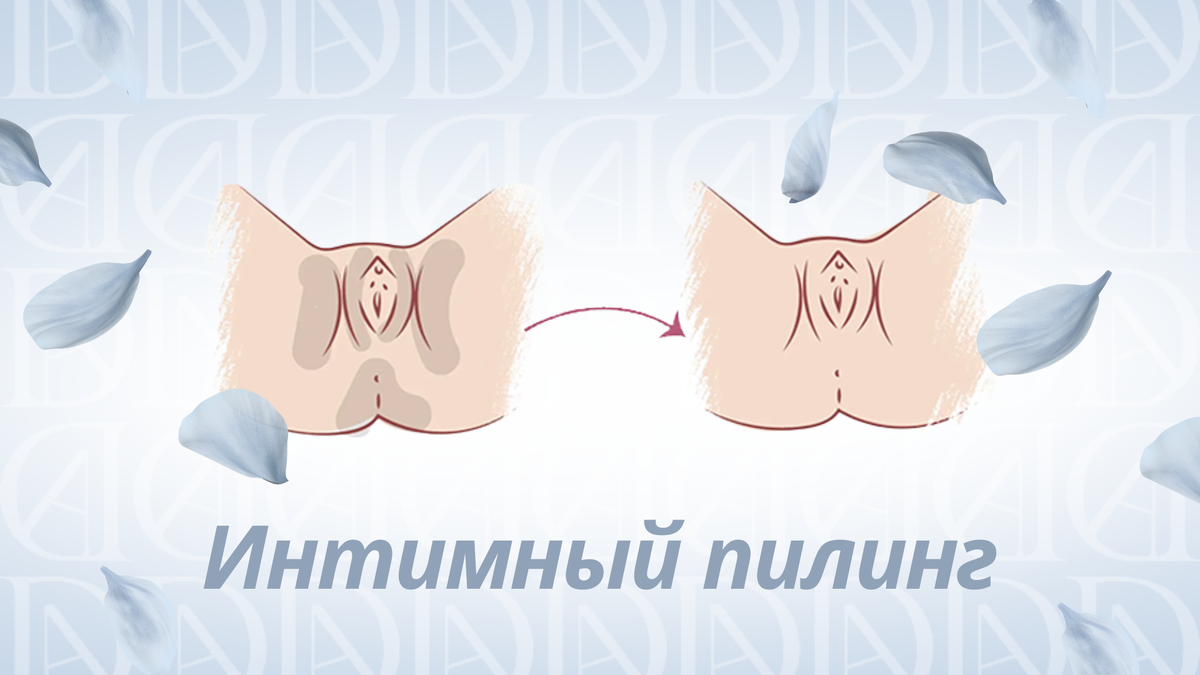 Про процедуру интимного отбеливания (осветления)