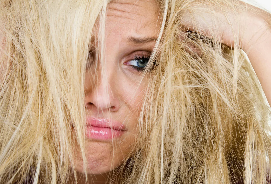Пересушенные и ломкие волосы. Источник фото nowtolove.co.nz