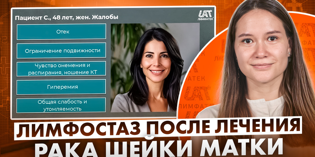 Лимфостаз после лечения рака шейки матки
