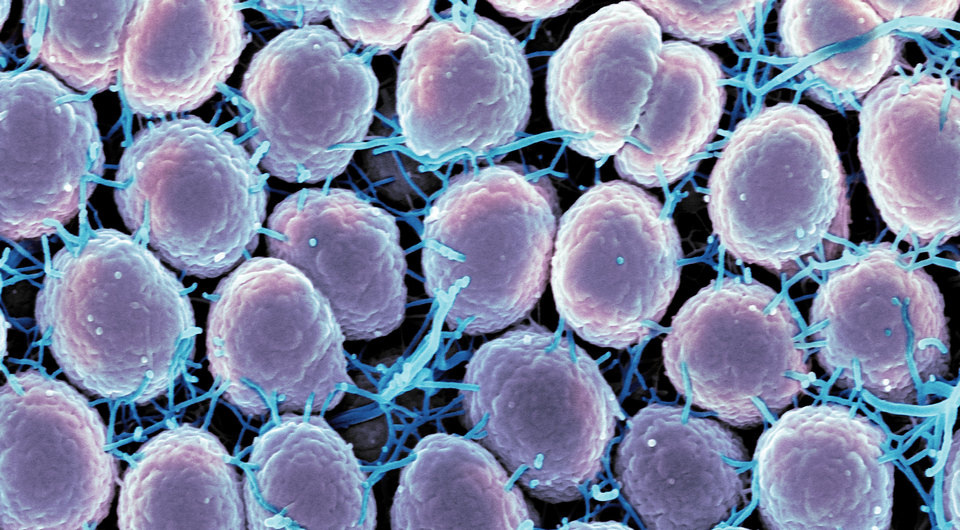   NIAID / Flickr / CC BY 2.0