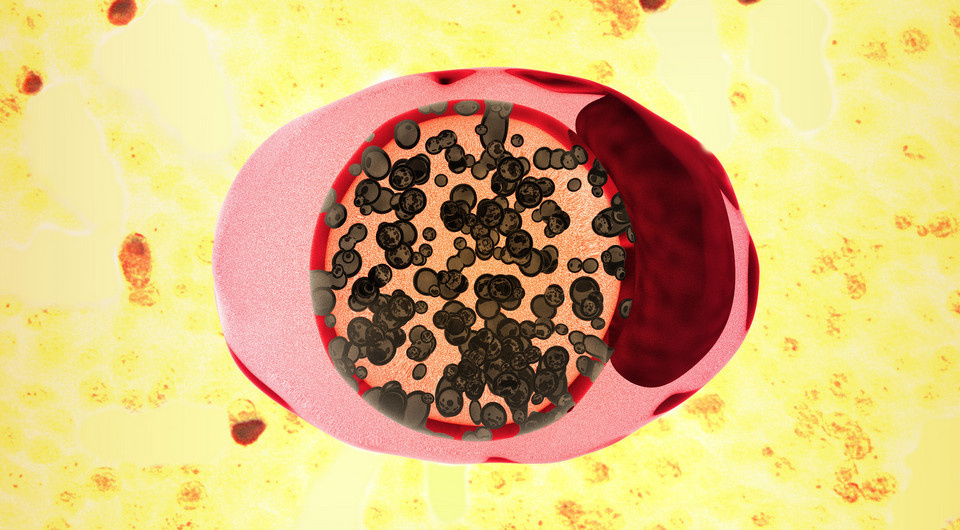   NIAID / Flickr / CC BY 2.0