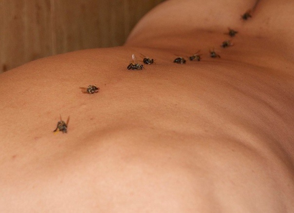 Апитерапия: как восстановить осанку и психическое состояние с помощью пчелиных укусов