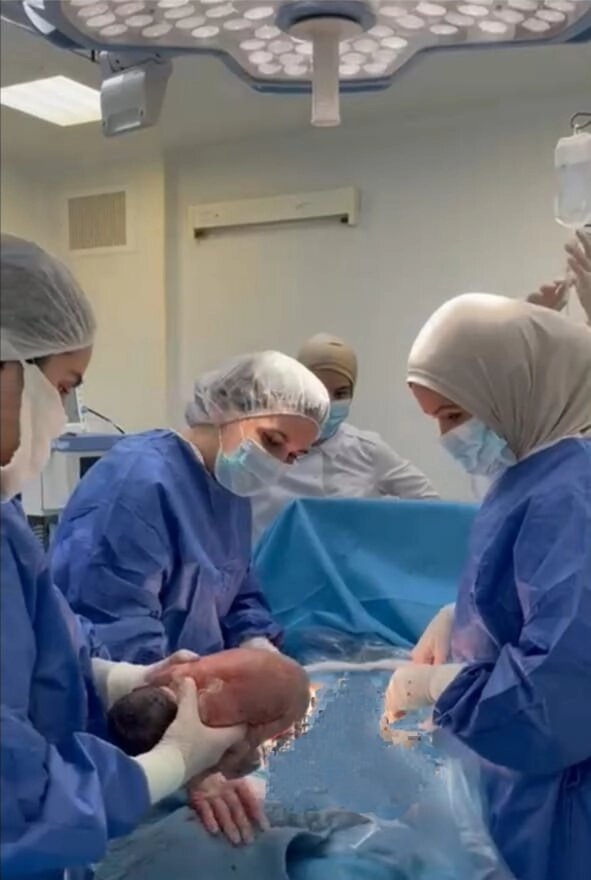    Женщине провели операцию кесарева сечения Фото: Кадр из видео/ Эльвира Бексултанова