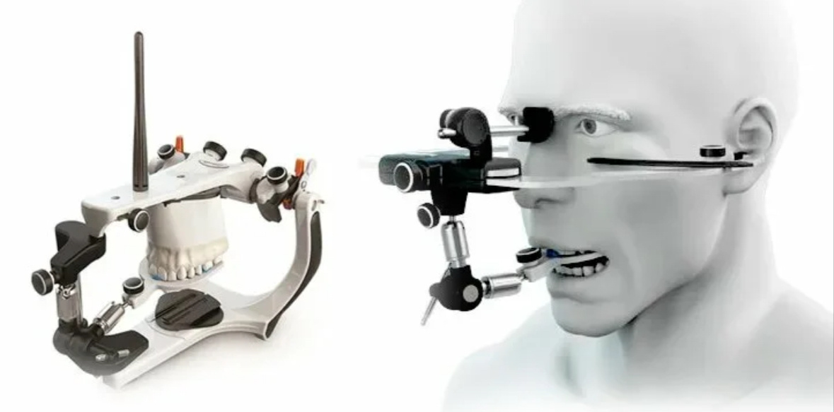 Лицевая дуга