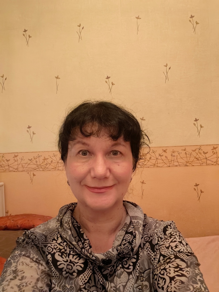 Вот так я выгляжу через месяц после операции. Снимала сама на вытянутой руке, без фильтров и практически без макияжа