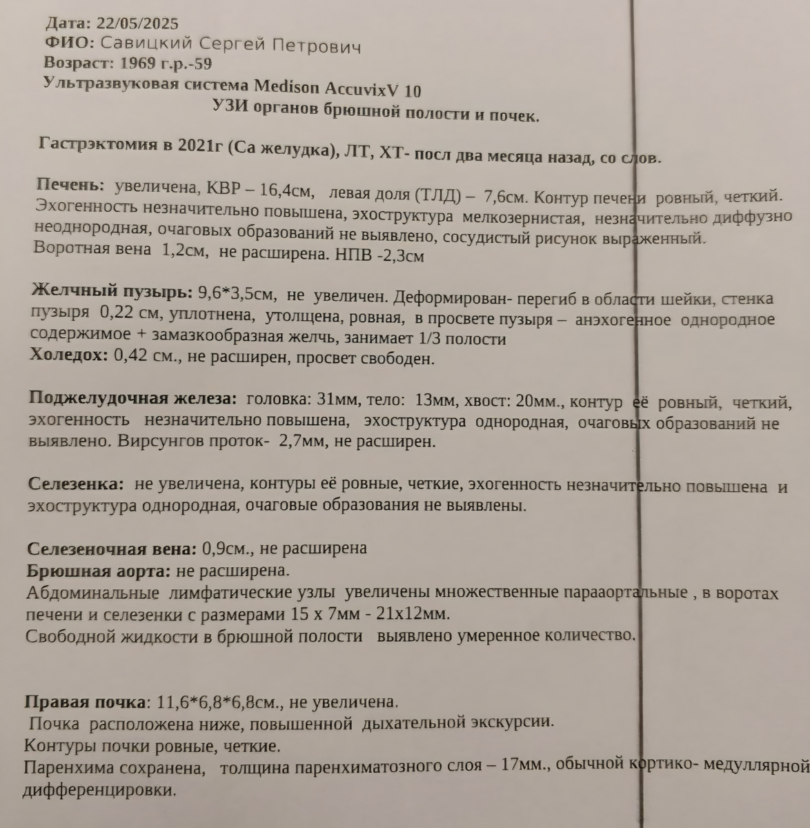 Начало. Фото автора 