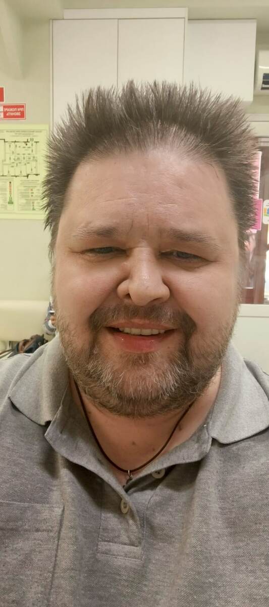 На фоте я только выполз от стоматолога и примерил временные зубья... Посмотрите: сколько Щастья в лице. Именно с большой буквы ЩА...