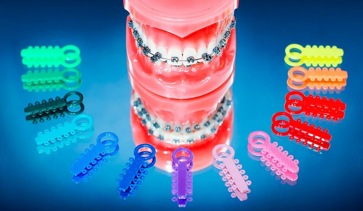 Эластичные кольца для брекетов