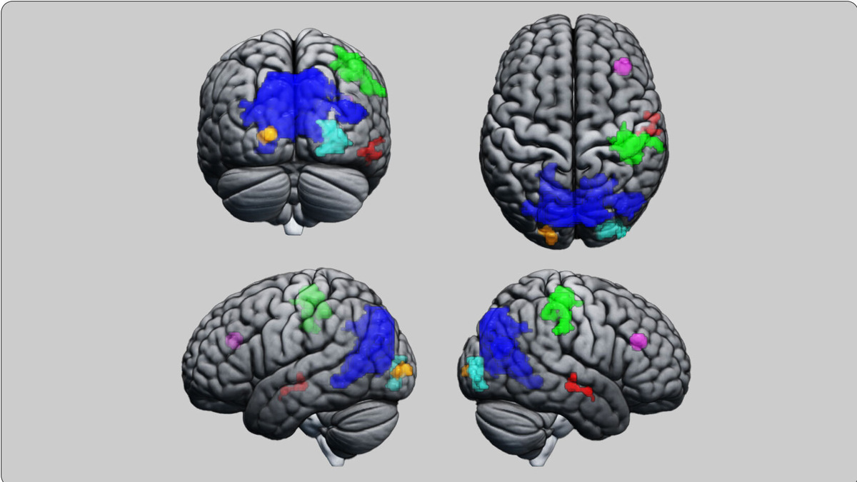 Фото: fMRI-Studie, Mike Brügger, UZH
В цвете показаны области мозга, функциональные связи которых были изменены в глубоком гипнозе