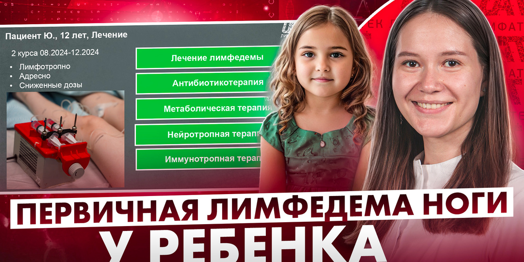 Первичная лимфедема ноги у ребенка