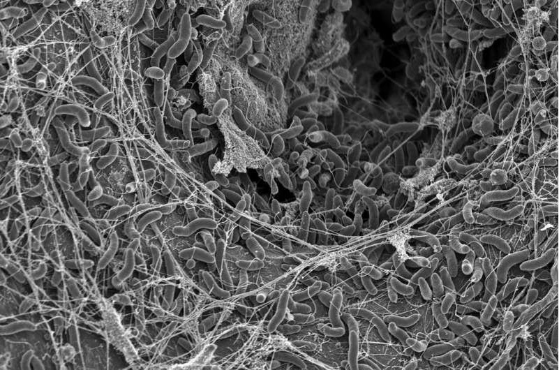    Бактерии V. cholerae, фотография, сделанная с помощью сканирующего электронного микроскопа. Авторы: Грэм Нотт и Мелани Блокеш (EPFL)