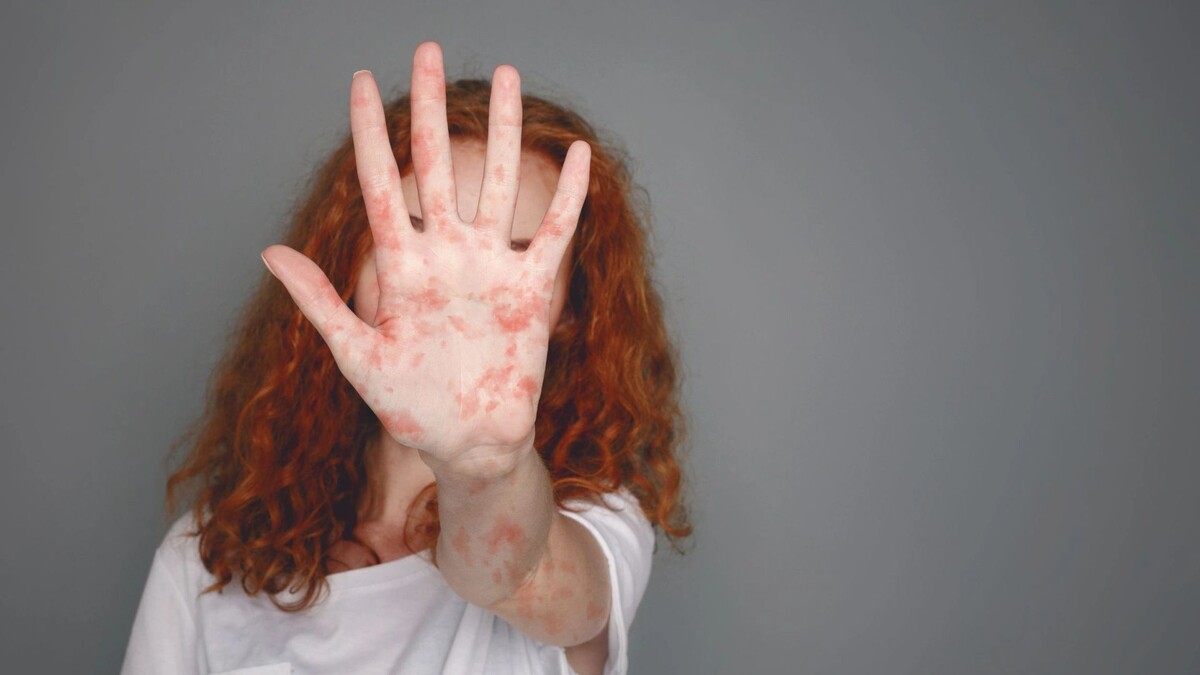    Фото: Prostock-studio/Shutterstock/Fotodom