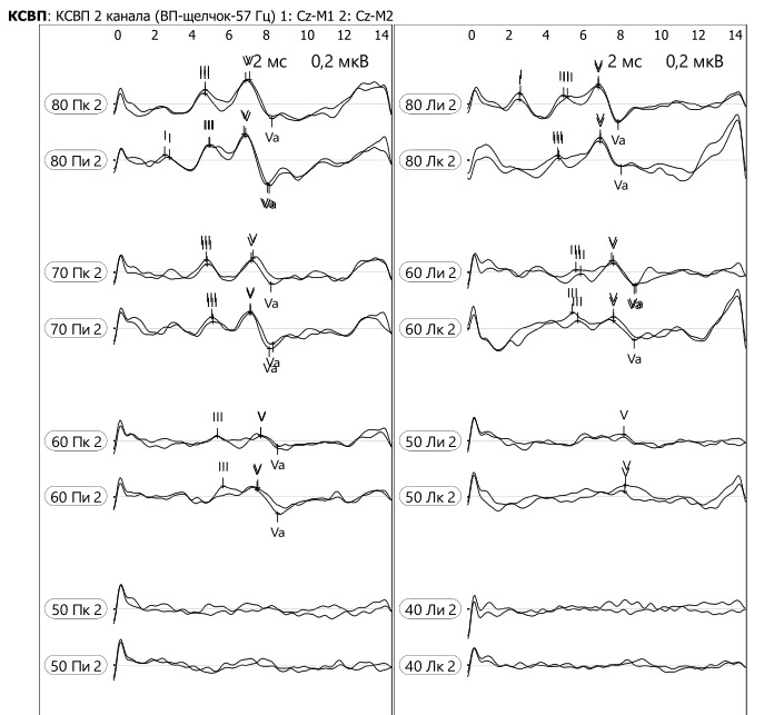 КСВП по воздушному проведению на щелчок