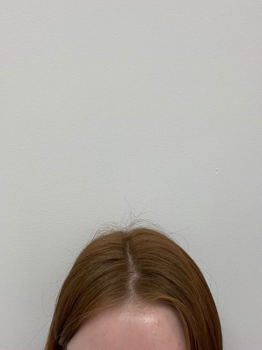-2-2