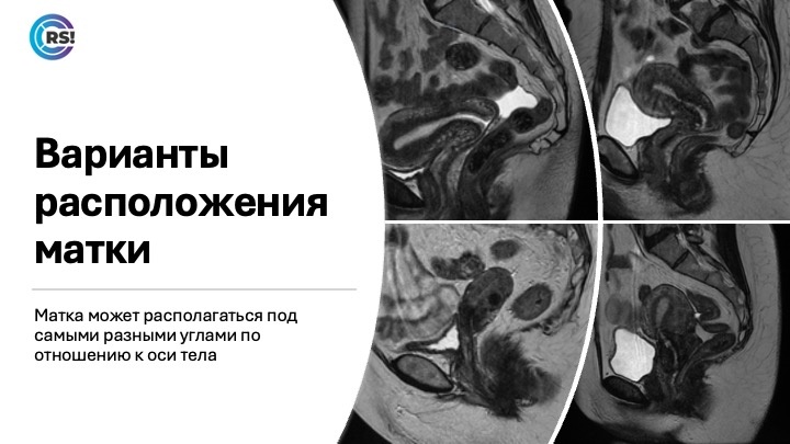 Перед вами четыре разных варианта  положения матки