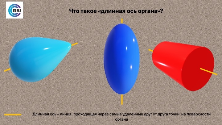 Желтая линия показывает нам направление длинной оси фигуры. 