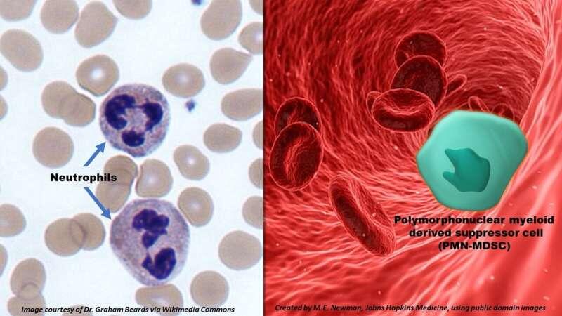 Микрофотография нейтрофилов (слева)           PMN-MDSC (справа)