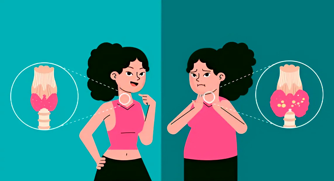 Щитовидная железы и ЖКТ