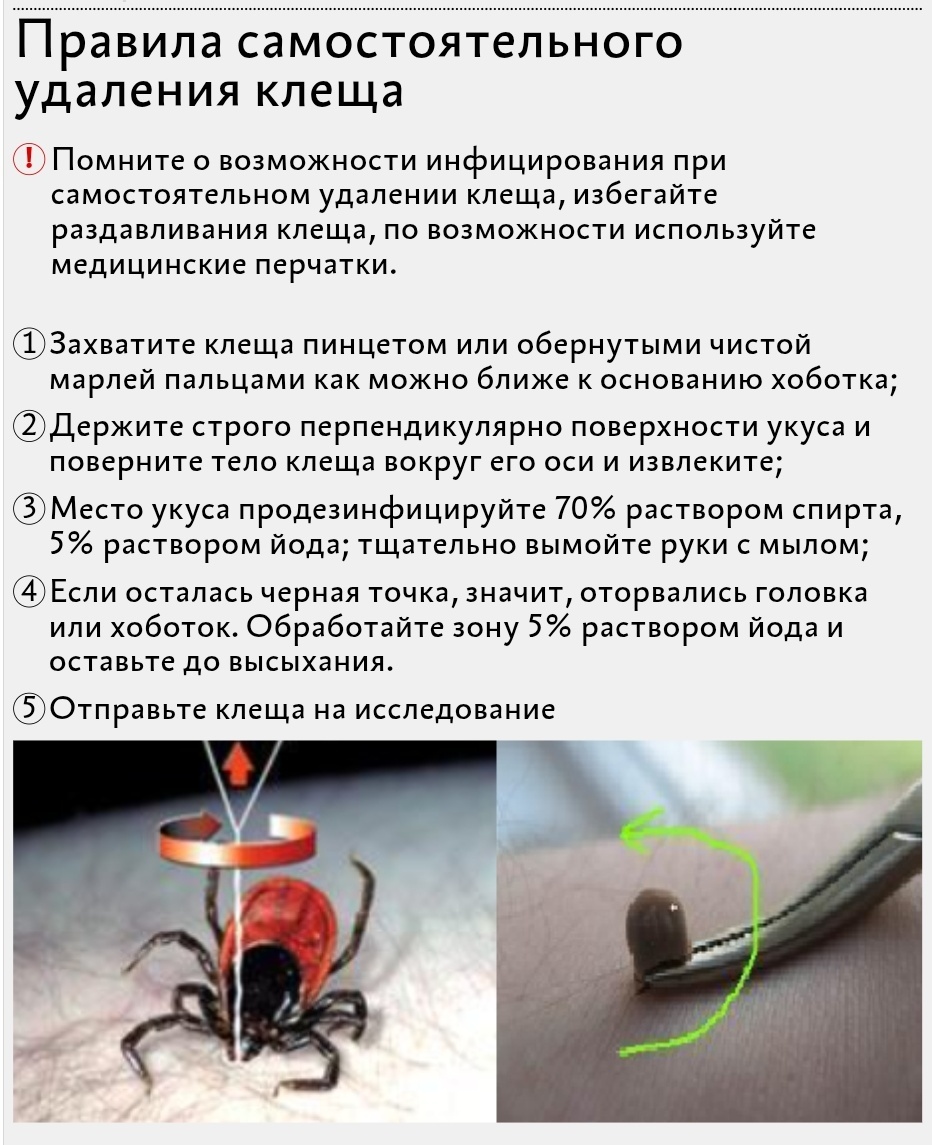 Правила самостоятельного удаления клеща
