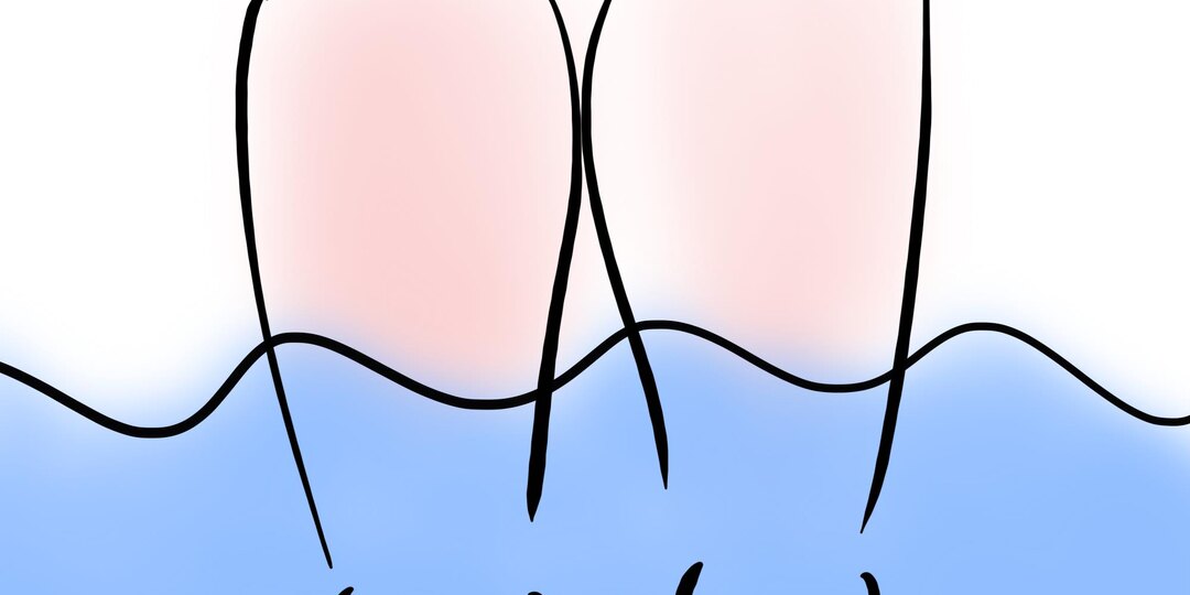 Может ли нимесулид дать наутро отек лодыжек и пальцев?