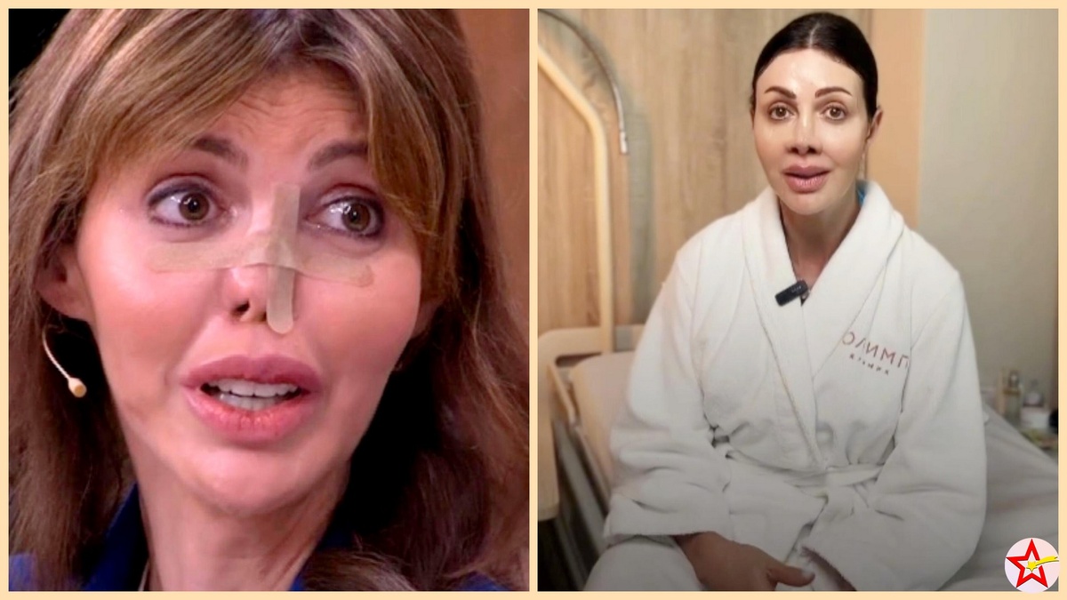 Алиса Аршавина показала лицо после 10 операций по восстановлению носа