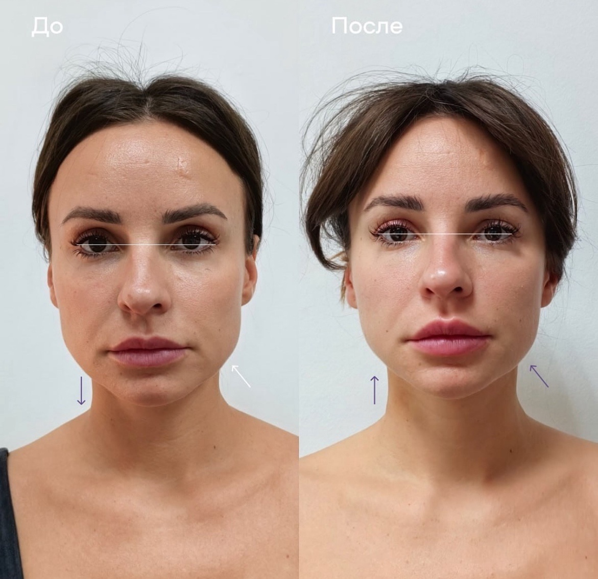 клиника "Остео лайт"