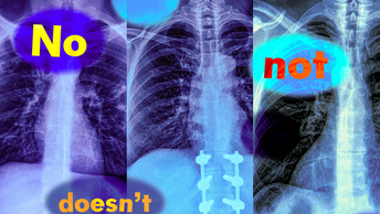 «Нет» — и в ответ тишина: почему мультимодальные ИИ-модели игнорируют отрицание