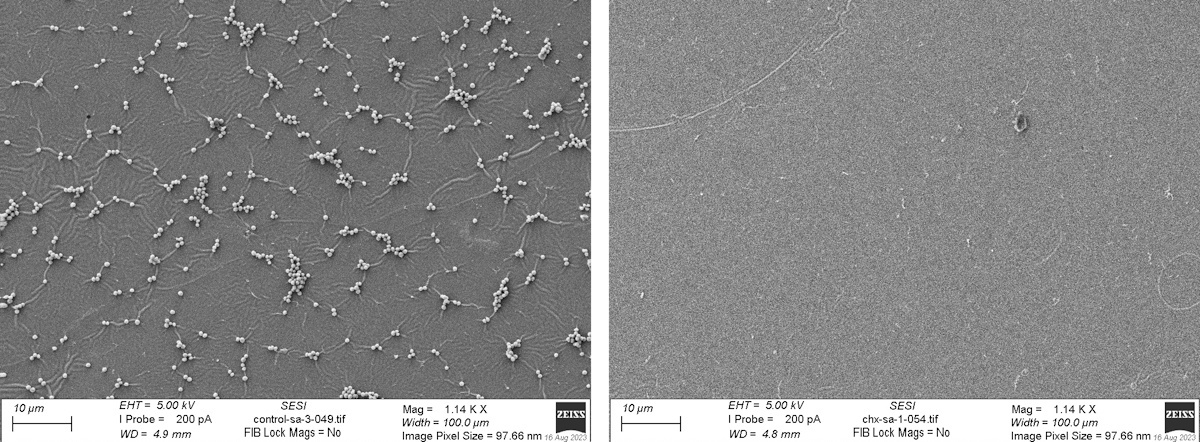 Противомикробная эффективность На снимках СЭМ стальных поверхностей, инокулированных бактериями, наблюдается большая концентрация бактерий на поверхностях, окрашенных контрольной эпоксидной смолой (слева), и практически полное отсутствие бактерий на поверхностях, окрашенных эпоксидной смолой с хлоргексидином. (предоставлено: Ноттингемским университетом)