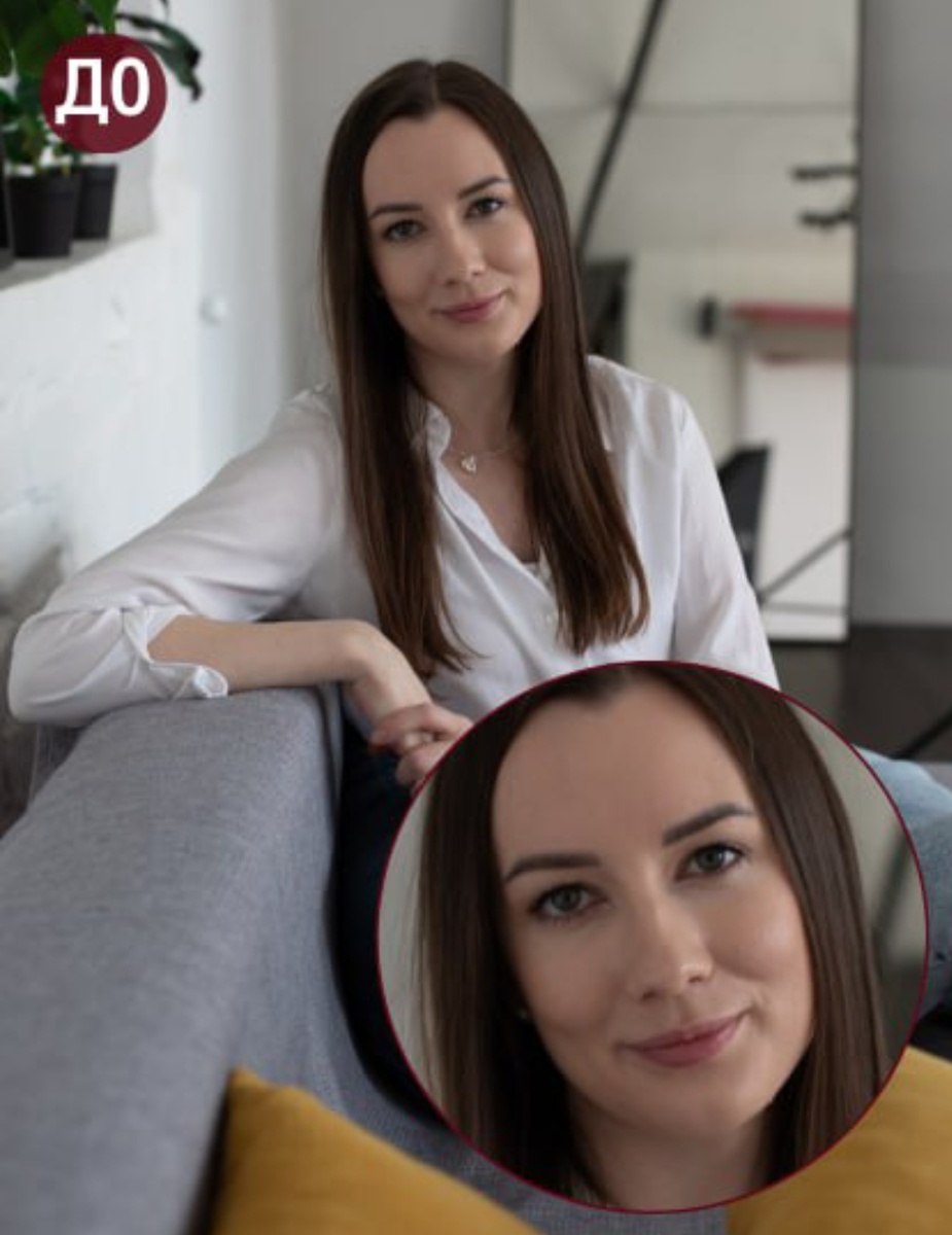 До операции 