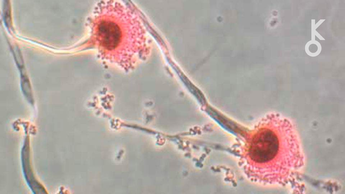 Грибок, способный «съесть нас изнутри»