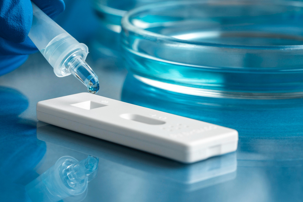 Тестирование на наркозависимость: как проходит и зачем нужно? (источник изображения: freepik.com)