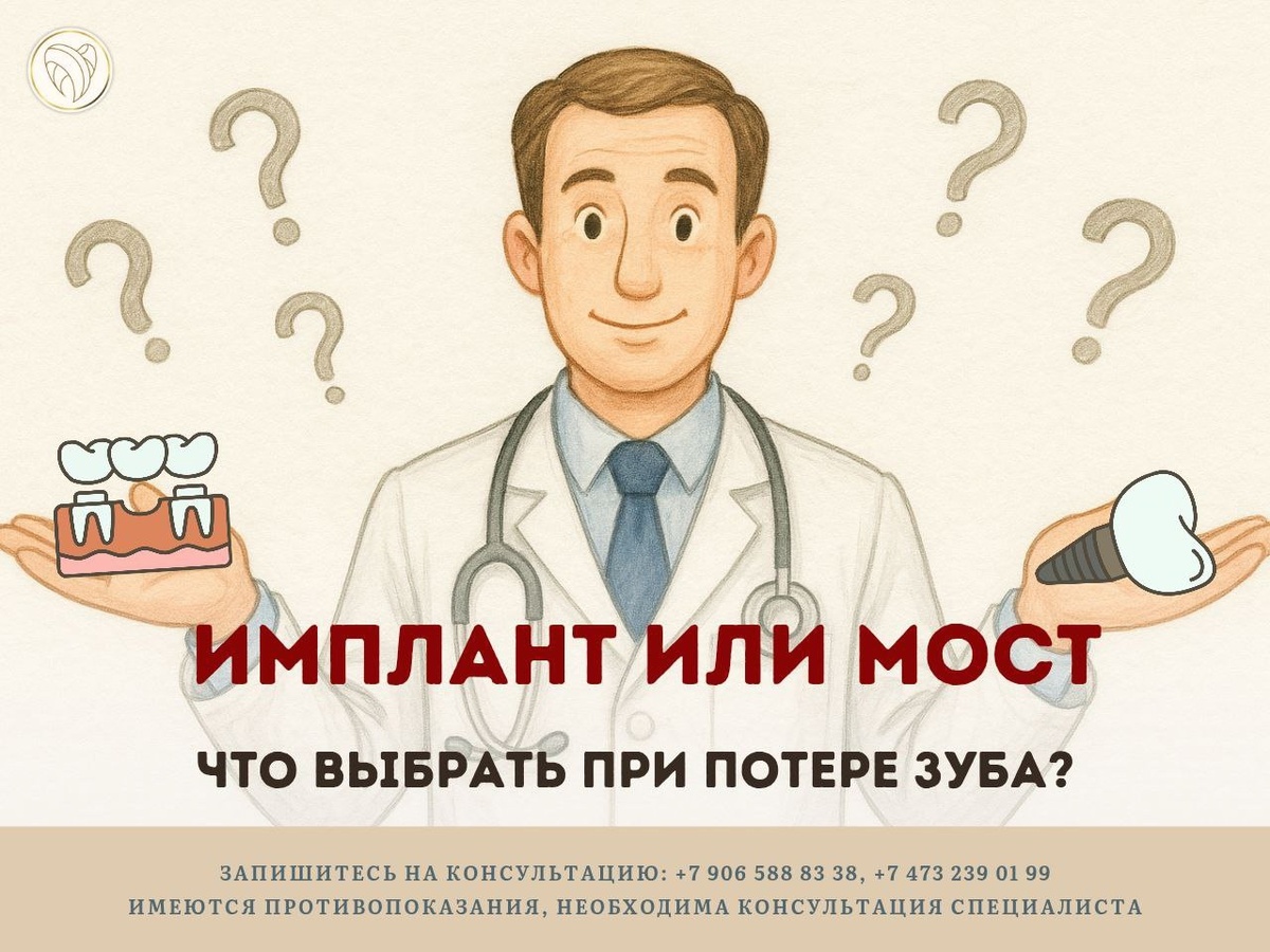 Зуб удалён. Что дальше? Имплант или мост - врач объясняет, что сохранит здоровье, а что маскирует проблему