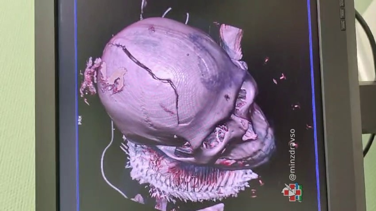 Фото: Министерство здравоохранения Свердловской области  📷
