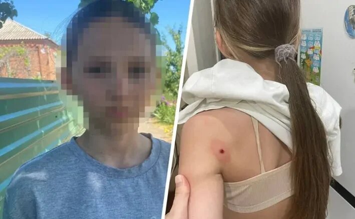    Пострадавшая девочка. Фото из телеграм-канала Леонида Заплаткина