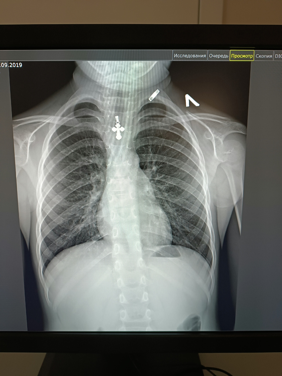 Причина моих переживаний. 
