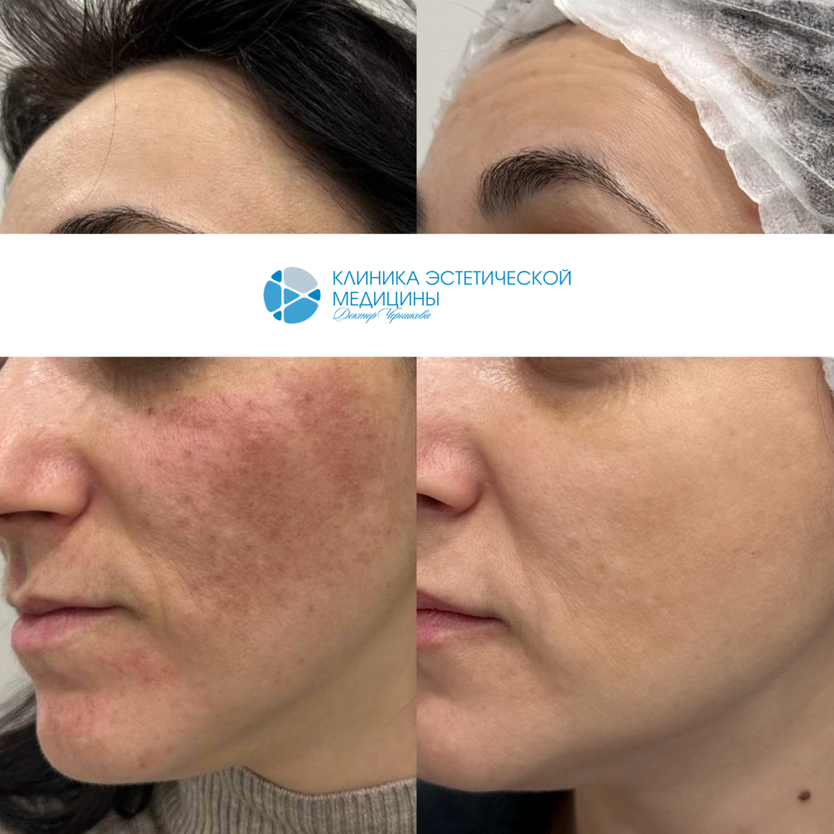 Результат до/после