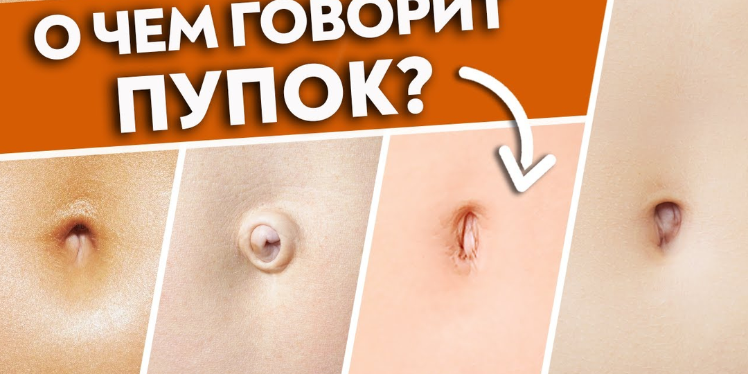 Диагностика органов по пупку | Пупок скажет ВСЁ о вашем здоровье! Постановка пупка на место