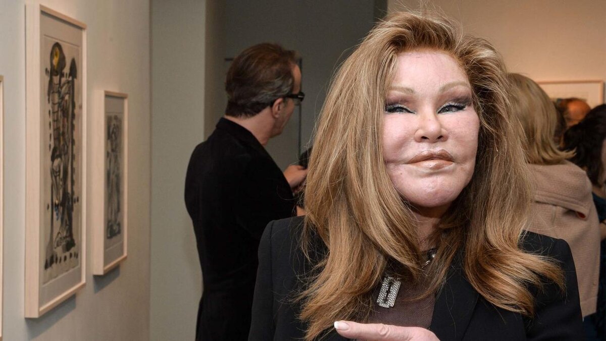 Джослин Вильденштейн