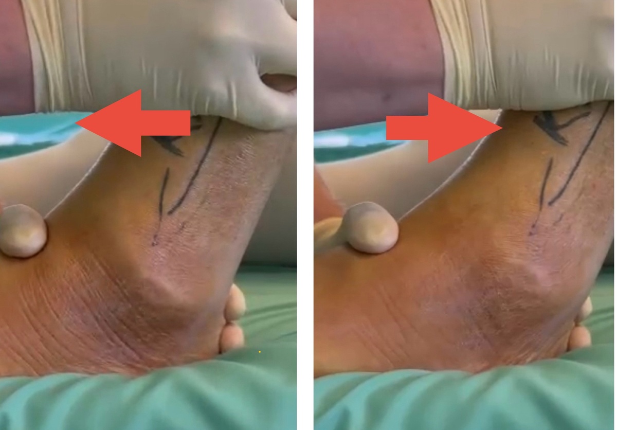 Тест выдвижного ящика - стопа ходит вперёд-назад